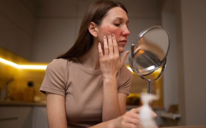 How Chronic Skin Conditions Impact Daily Life & Confidence